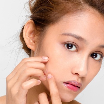 تاثیرات بلوغ، بارداری و یائسگی روی پوست خانم ها