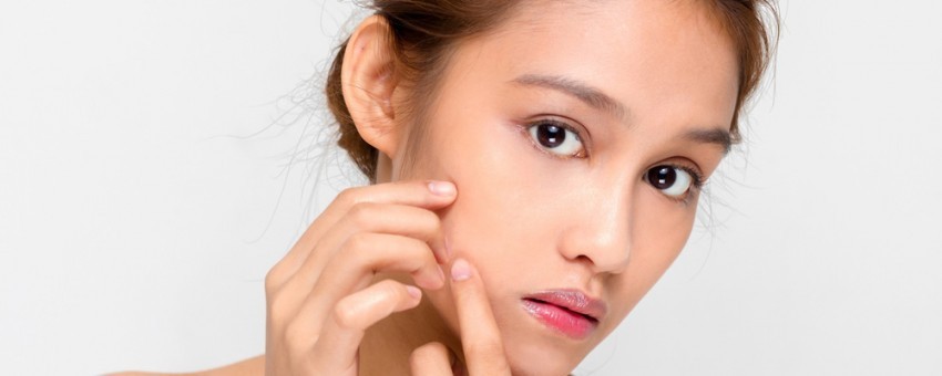 تاثیرات بلوغ، بارداری و یائسگی روی پوست خانم ها